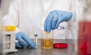 دستگاه حمل‌ و جمع‌آوری ادرار شرکت کوپان دایاگنوستیکس مجوز FDA را گرفت