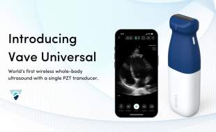 نخستین اولتراسوند بی‌سیم، دستی و تمام‌بدن جهان با یک مبدل PZT به بازار عرضه شد