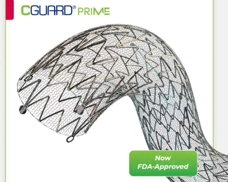 عرضه سیستم استنت کاروتید CGuard® Prime برای پیشگیری از سکته مغزی در آمریکا