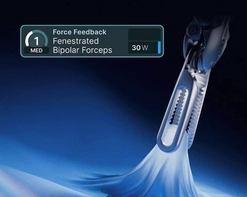 قابلیت‌های نرم‌افزاری جدید داوینچی ۵؛ گامی به سوی جراحی ایمن‌تر و کارآمدتر