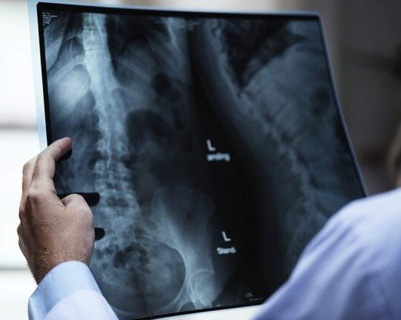 رییس انجمن رادیولوژی: تعرفه خدمات تصویربرداری متناسب با تورم رشد نکرده است