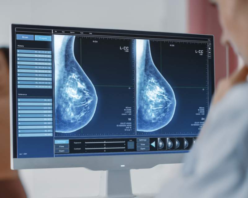 توسعه سامانه هوشمند دستیار رادیولوژی برای تشخیص زودرس سرطان پستان
