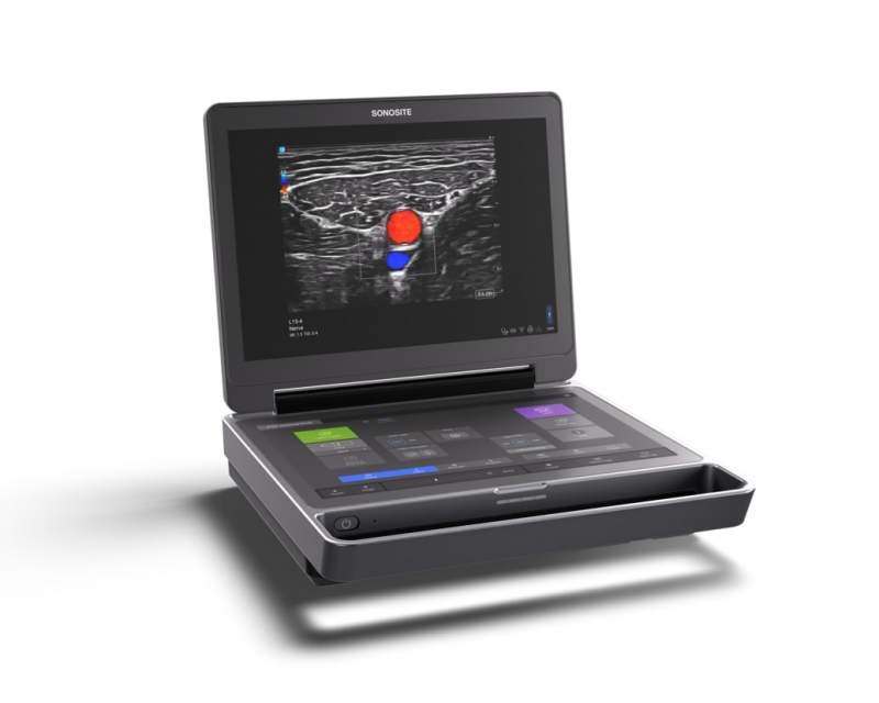 رونمایی از سیستم اولتراسوند جدید پرتابل فوجی فیلم سونوسایت