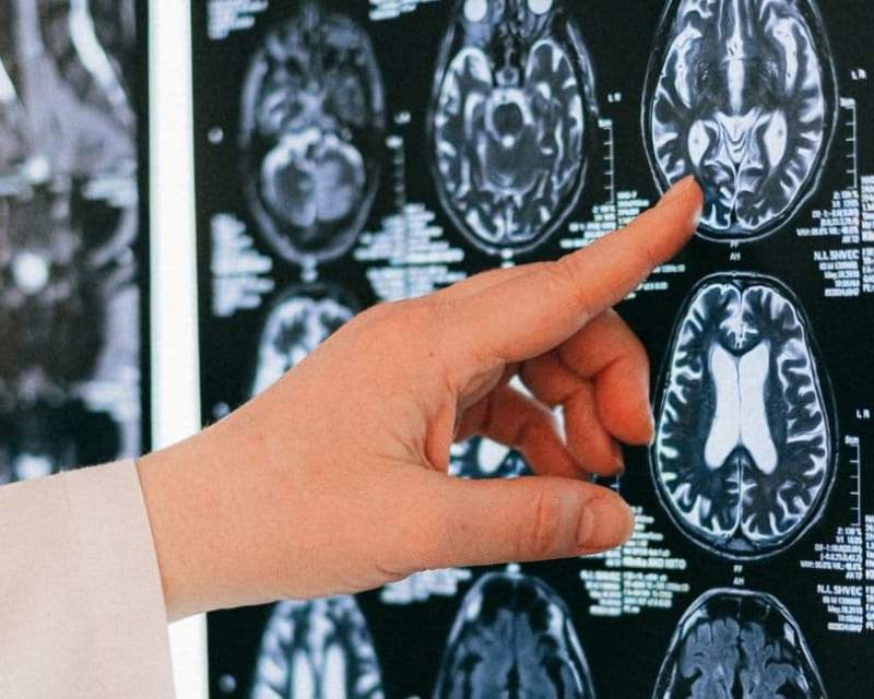 فاصله زیاد رادیولوژی ایران با تکنولوژی روز