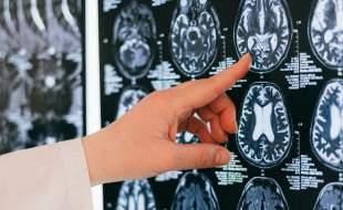 فاصله زیاد رادیولوژی ایران با تکنولوژی روز