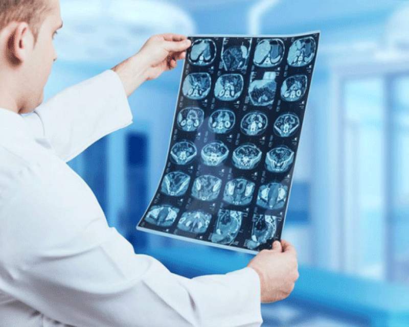 انتقاد از دخالت افراد فاقد صلاحیت در حوزه رادیولوژی