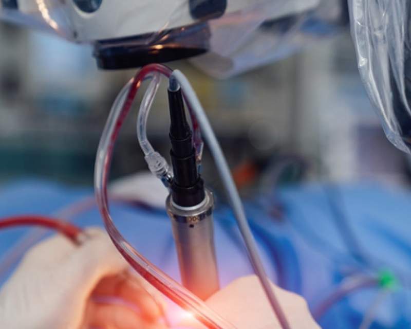 اولین جراحی رباتیک از راه دور برای درمان سکته مغزی