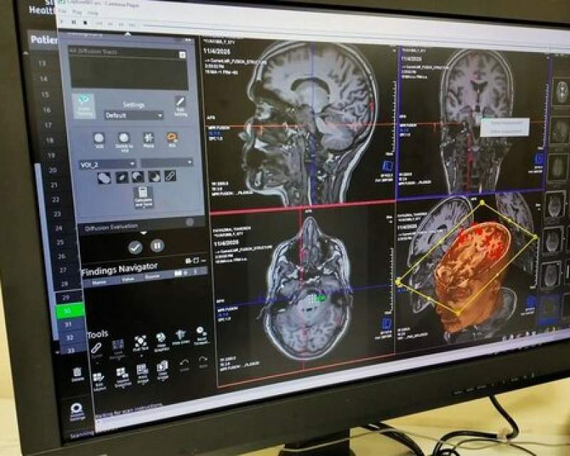 تجهیز نرم افزارهای پیشرفته واحد MRI بیمارستان سینا به همت خانواده یک خیر سلامت