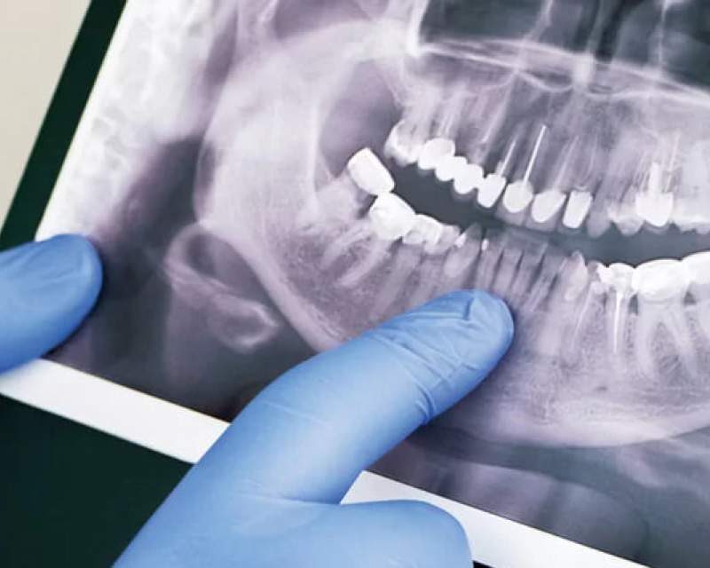 توسعه سامانه هوشمند تحلیل تصاویر دندانپزشکی توسط پژوهشگران دانشگاه تهران توسعه سامانه هوشمند تحلیل تصاویر دندانپزشکی توسط پژوهشگران دانشگاه تهران