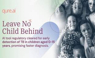 نخستین ابزار هوش مصنوعی برای غربالگری سل نوزادان و کودکان تا ۱۵ سال تائید شد