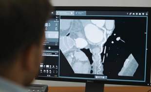 بهبود مدیریت بیماری عروق کرونر با نرم‌افزار جدید زیمنس هلثینرز