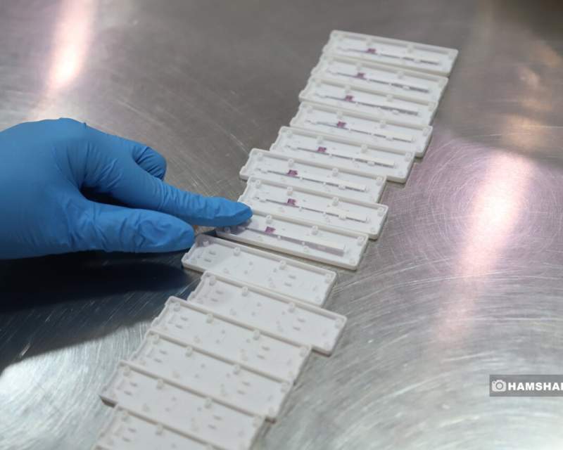 تشخیص زودهنگام و درمان نوین؛ پشت درهای پژوهشکده کبد و گوارش تشخیص زودهنگام و درمان نوین؛ پشت درهای پژوهشکده کبد و گوارش