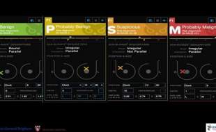ورود هوش مصنوعی به سونوگرافی و کاهش ۶۰ درصدی بیوپسی‌های غیرضروری پستان