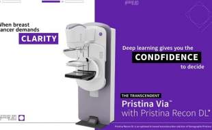 هوش مصنوعی کیفیت تصویر ماموگرافی را ارتقا می‌دهد