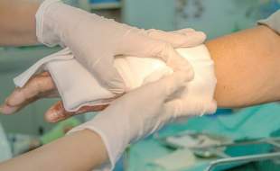 پانسمان‌های نوین تحت پوشش بیمه قرار گرفت