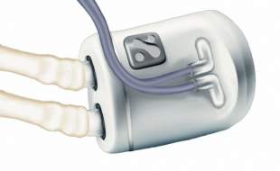 هولی؛ دستگاه کاشتنی که دیالیز را وارد عصری جدید می‌کند