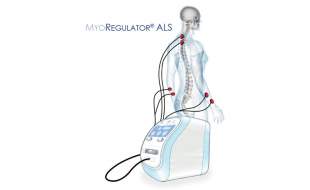 دستگاه مایورگولاتور از FDA رتبه "دستگاه پیشگام" گرفت