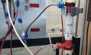 ساخت نمونه آزمایشگاهی ریه مصنوعی با استفاده از فیلترهای همودیالیز