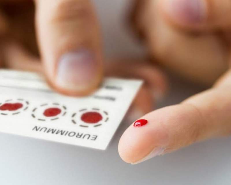 تشخیص آلزایمر با آزمایش خون ساده