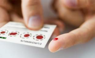 تشخیص آلزایمر با آزمایش خون ساده