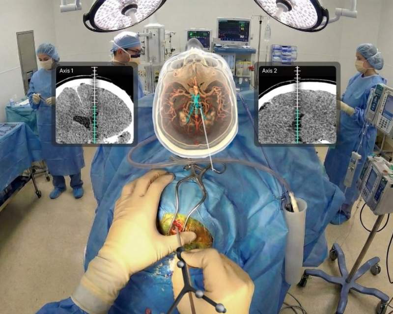 نخستین سامانه واقعیت افزوده در جهان برای ناوبری جراحی مغز و اعصاب مجوز گرفت