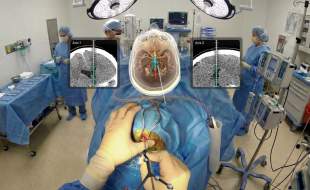 نخستین سامانه واقعیت افزوده در جهان برای ناوبری جراحی مغز و اعصاب مجوز گرفت