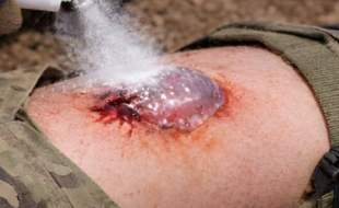 توقف یک ثانیه‌ای خونریزی ممکن شد