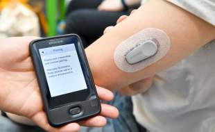 تقاضای بالا برای CGMها، درآمد دکسکام را افزایش داد