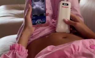 سونوگرافی خانگی برای مادران باردار